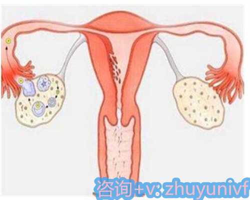 深圳正规医院代孕服务助不孕不育夫妇圆亲生父母梦